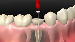 Urgencia Odontologica